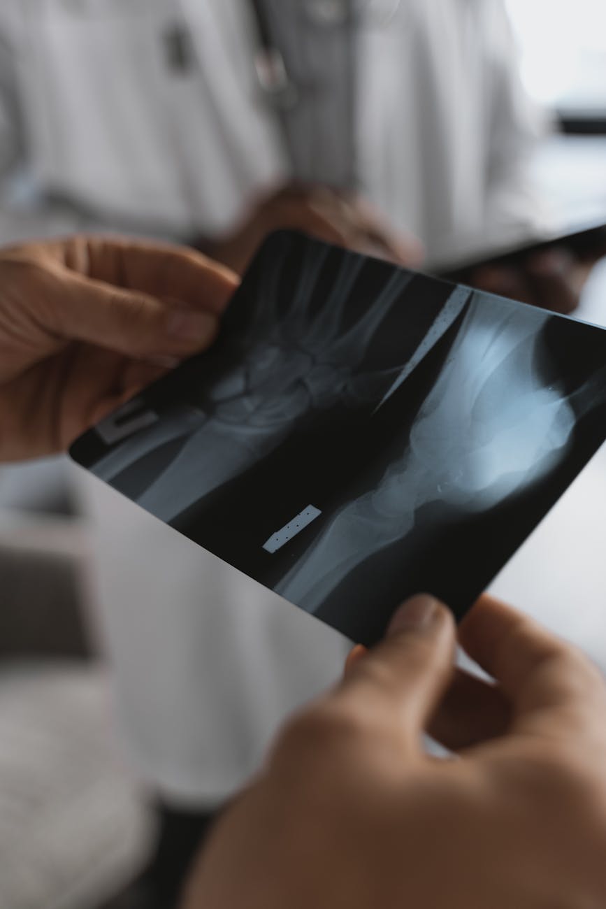 close up photo of an x ray held by a doctor