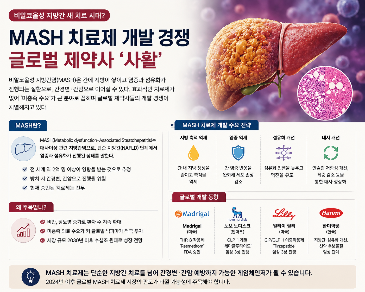 MASH 치료제 2종뿐인데 환자는 3억명… 뜨거워진 치료제 시장