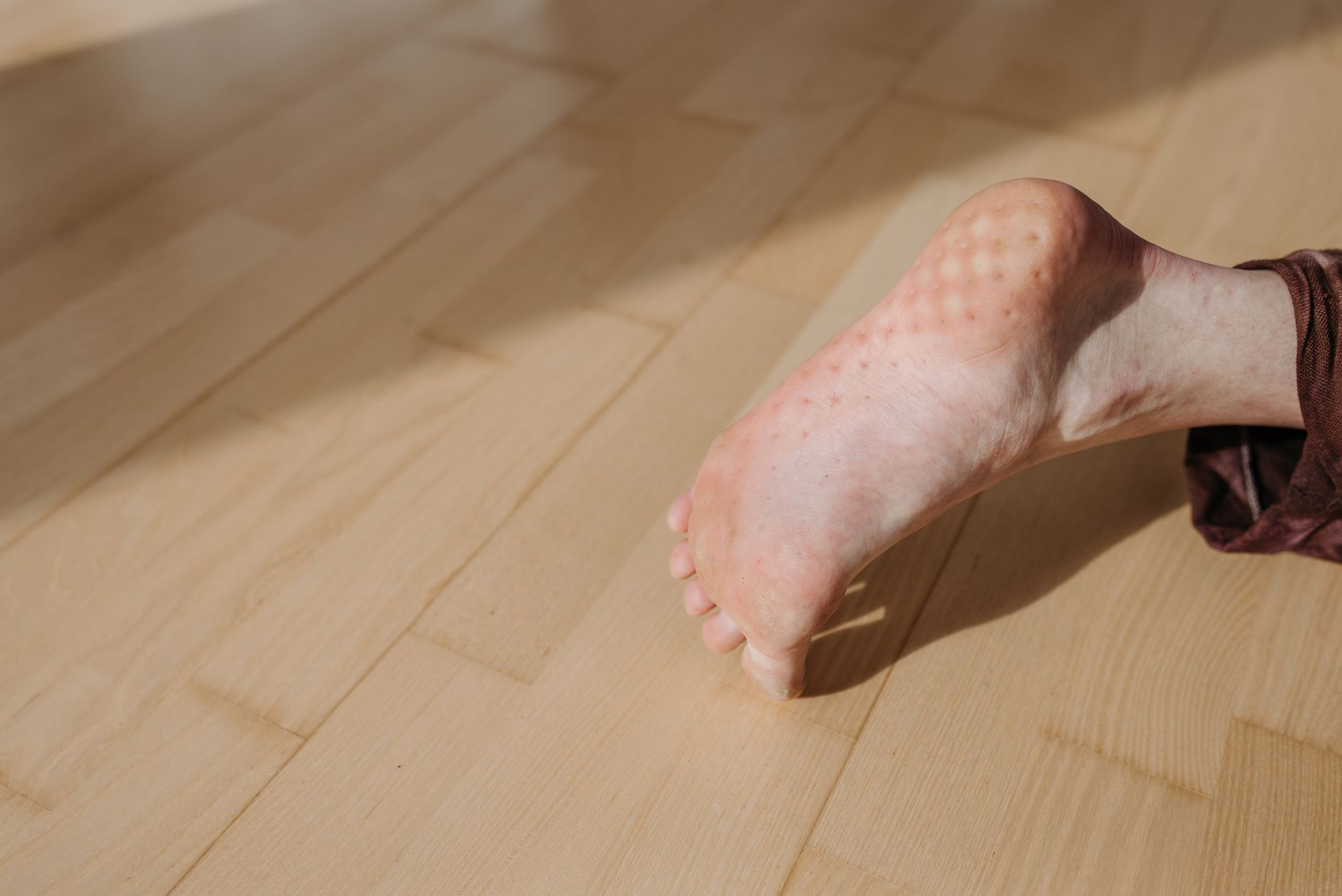 foot of a man lying on the floor with puncture marks